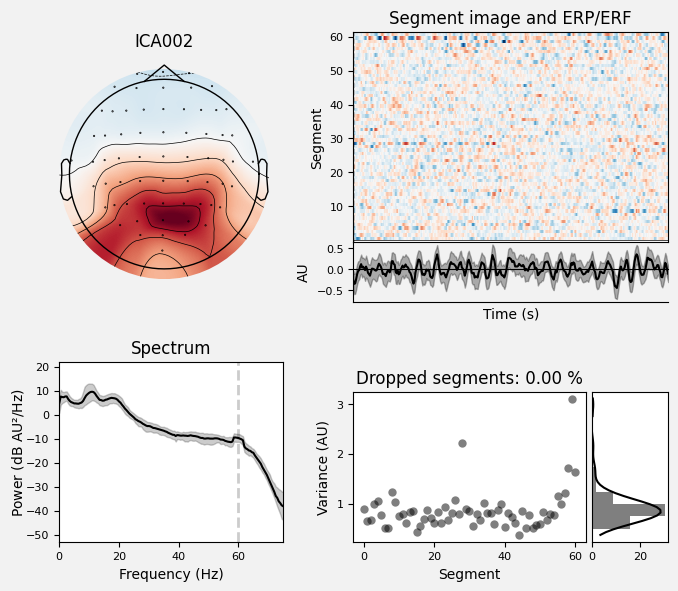 _images/train_network_eeg_1_84.png