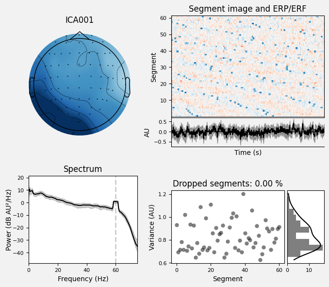 _images/train_network_eeg_1_90.png