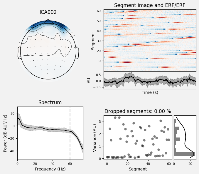 _images/train_network_eeg_1_91.png