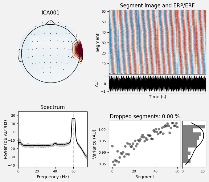 _images/train_network_eeg_1_95.png