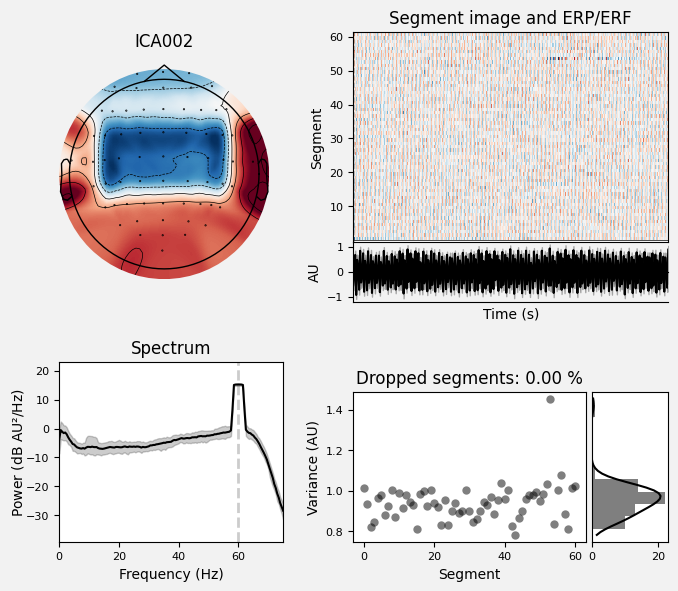 _images/train_network_eeg_1_96.png